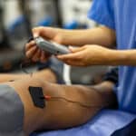 nerve stimulation closeup